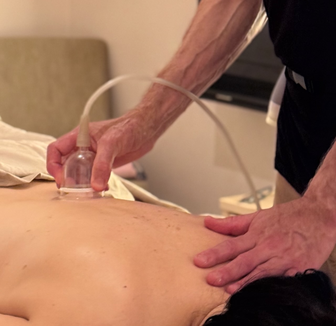 Power cupping frees bound muscle and connective tissue